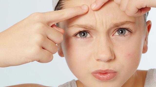 濕疹會傳染嗎？如何調(diào)理才能防止復發(fā)？